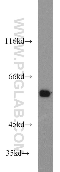 MTA3 Rabbit anti-Human, Mouse, Rat, Polyclonal, Proteintech:Antibodies:Primary