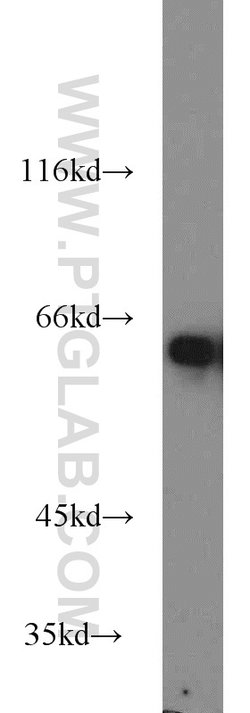 MTA3 Rabbit anti-Human, Mouse, Rat, Polyclonal, Proteintech:Antibodies:Primary