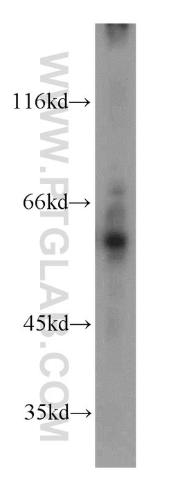 MTA3 Rabbit anti-Human, Mouse, Rat, Polyclonal, Proteintech:Antibodies:Primary
