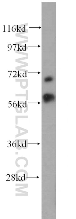 MTA3 Rabbit anti-Human, Mouse, Rat, Polyclonal, Proteintech:Antibodies:Primary