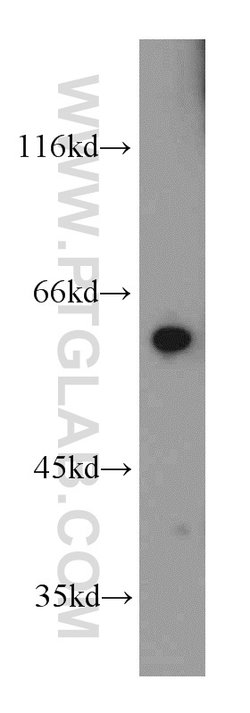 MTA3 Rabbit anti-Human, Mouse, Rat, Polyclonal, Proteintech:Antibodies:Primary