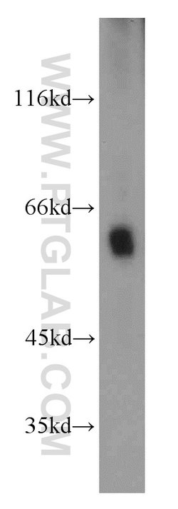 MTA3 Rabbit anti-Human, Mouse, Rat, Polyclonal, Proteintech:Antibodies:Primary