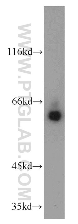 MTA3 Rabbit anti-Human, Mouse, Rat, Polyclonal, Proteintech:Antibodies:Primary