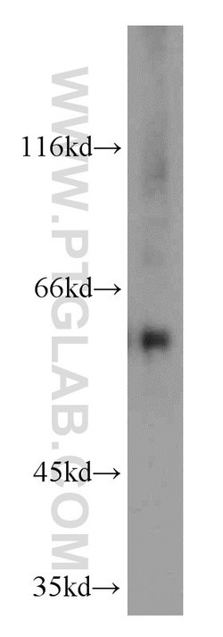 MTA3 Rabbit anti-Human, Mouse, Rat, Polyclonal, Proteintech:Antibodies:Primary