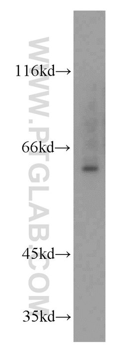 MTA3 Rabbit anti-Human, Mouse, Rat, Polyclonal, Proteintech:Antibodies:Primary