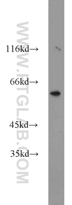 MTA3 Rabbit anti-Human, Mouse, Rat, Polyclonal, Proteintech:Antibodies:Primary