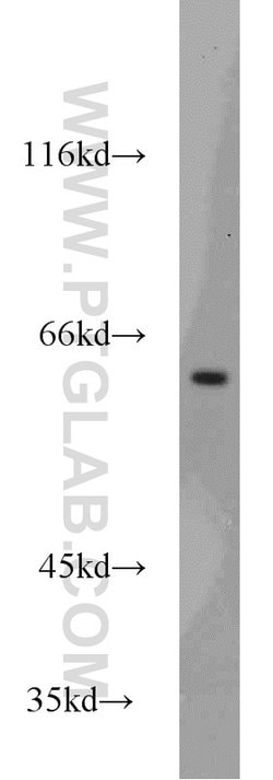 MTA3 Rabbit anti-Human, Mouse, Rat, Polyclonal, Proteintech:Antibodies:Primary