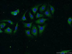 NBAS Rabbit anti-Human, Mouse, Rat, Polyclonal, Proteintech 150 &mu;L;