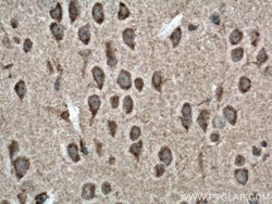 NBAS Rabbit anti-Human, Mouse, Rat, Polyclonal, Proteintech 150 &mu;L;