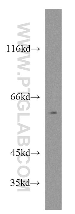 RXRB Rabbit anti-Human, Mouse, Rat, Polyclonal, Proteintech 150 &mu;L;