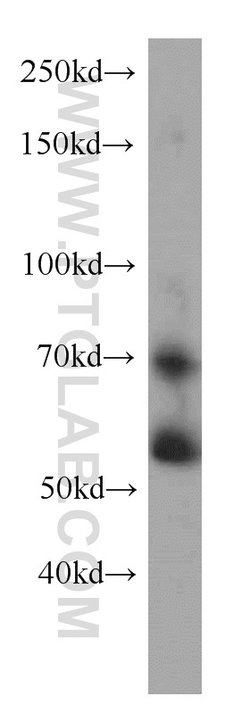 RXRB Rabbit anti-Human, Mouse, Rat, Polyclonal, Proteintech 150 &mu;L;