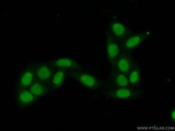 DIS3 Rabbit anti-Human, Mouse, Rat, Polyclonal, Proteintech 150 &mu;L;
