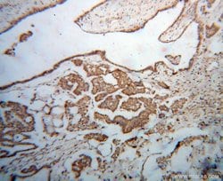 DIS3 Rabbit anti-Human, Mouse, Rat, Polyclonal, Proteintech 150 &mu;L;