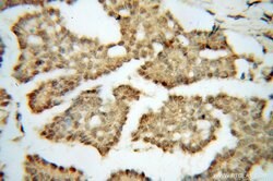 DIS3 Rabbit anti-Human, Mouse, Rat, Polyclonal, Proteintech 150 &mu;L;