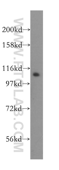 DIS3 Rabbit anti-Human, Mouse, Rat, Polyclonal, Proteintech 150 &mu;L;