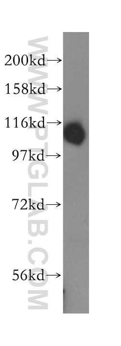 DIS3 Rabbit anti-Human, Mouse, Rat, Polyclonal, Proteintech 150 &mu;L;