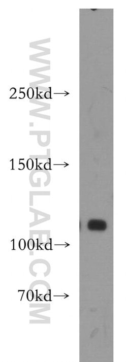 DIS3 Rabbit anti-Human, Mouse, Rat, Polyclonal, Proteintech 150 &mu;L;