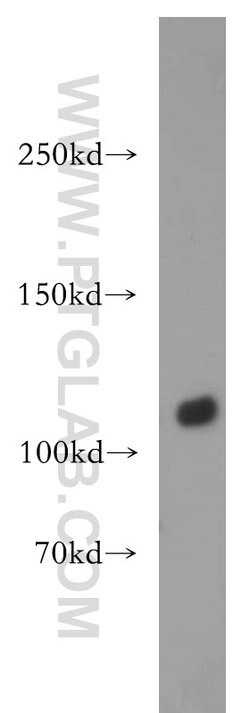 DIS3 Rabbit anti-Human, Mouse, Rat, Polyclonal, Proteintech 150 &mu;L;