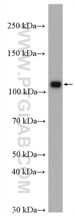 DIS3 Rabbit anti-Human, Mouse, Rat, Polyclonal, Proteintech 150 &mu;L;