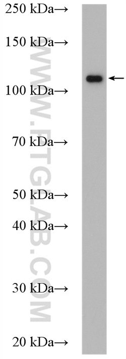 DIS3 Rabbit anti-Human, Mouse, Rat, Polyclonal, Proteintech 150 &mu;L;