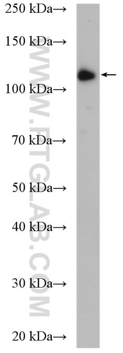 DIS3 Rabbit anti-Human, Mouse, Rat, Polyclonal, Proteintech 150 &mu;L;