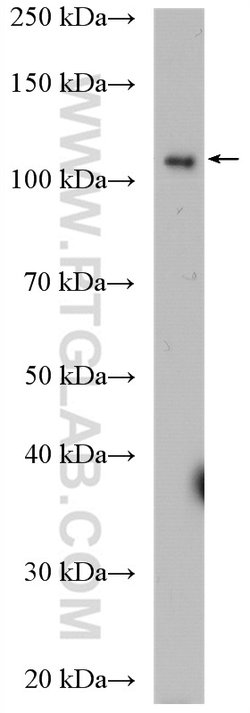 DIS3 Rabbit anti-Human, Mouse, Rat, Polyclonal, Proteintech 150 &mu;L;