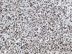 Thumbnail_AGAP2 Rabbit anti-Human, Mouse, Rat, Polyclonal, Proteintech:Antibodies:Primary