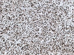 AGAP2 Rabbit anti-Human, Mouse, Rat, Polyclonal, Proteintech:Antibodies:Primary