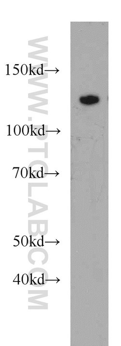 AGAP2 Rabbit anti-Human, Mouse, Rat, Polyclonal, Proteintech:Antibodies:Primary