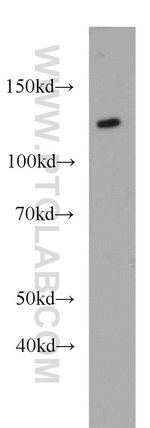 Thumbnail_AGAP2 Rabbit anti-Human, Mouse, Rat, Polyclonal, Proteintech:Antibodies:Primary