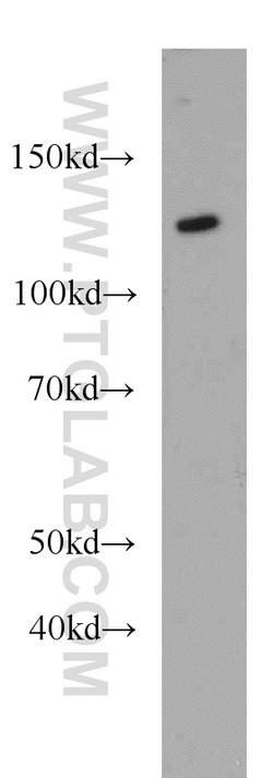 AGAP2 Rabbit anti-Human, Mouse, Rat, Polyclonal, Proteintech:Antibodies:Primary
