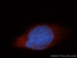 Thumbnail_AGAP2 Rabbit anti-Human, Mouse, Rat, Polyclonal, Proteintech:Antibodies:Primary