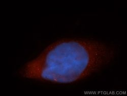 AGAP2 Rabbit anti-Human, Mouse, Rat, Polyclonal, Proteintech:Antibodies:Primary