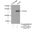 Thumbnail_AGAP2 Rabbit anti-Human, Mouse, Rat, Polyclonal, Proteintech:Antibodies:Primary