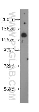 Thumbnail_AGAP2 Rabbit anti-Human, Mouse, Rat, Polyclonal, Proteintech:Antibodies:Primary