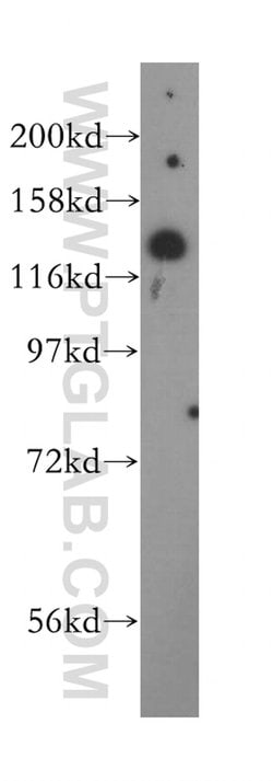 AGAP2 Rabbit anti-Human, Mouse, Rat, Polyclonal, Proteintech:Antibodies:Primary