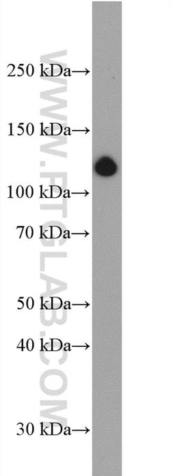 Collagen Type I Rabbit anti-Human, Mouse, Porcine, Rat, Polyclonal, Proteintech