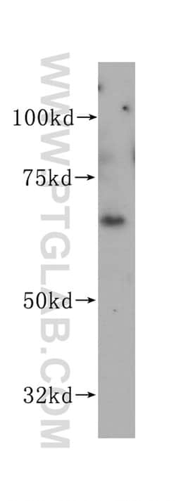 VANGL1 Rabbit anti-Human, Mouse, Rat, Polyclonal, Proteintech:Antibodies:Primary
