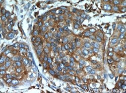 GRP94 Rabbit anti-Human, Mouse, Rat, Polyclonal, Proteintech:Anticuerpos:Anticuerpos