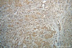 GRP94 Rabbit anti-Human, Mouse, Rat, Polyclonal, Proteintech:Anticuerpos:Anticuerpos
