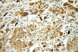 GRP94 Rabbit anti-Human, Mouse, Rat, Polyclonal, Proteintech:Anticuerpos:Anticuerpos