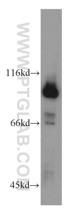 GRP94 Rabbit anti-Human, Mouse, Rat, Polyclonal, Proteintech:Anticuerpos:Anticuerpos