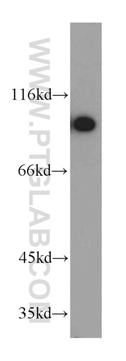 GRP94 Rabbit anti-Human, Mouse, Rat, Polyclonal, Proteintech:Anticuerpos:Anticuerpos