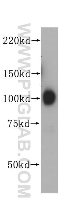GRP94 Rabbit anti-Human, Mouse, Rat, Polyclonal, Proteintech:Anticuerpos:Anticuerpos