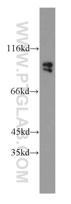 GRP94 Rabbit anti-Human, Mouse, Rat, Polyclonal, Proteintech:Anticuerpos:Anticuerpos