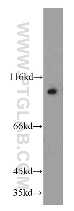 GRP94 Rabbit anti-Human, Mouse, Rat, Polyclonal, Proteintech:Anticuerpos:Anticuerpos