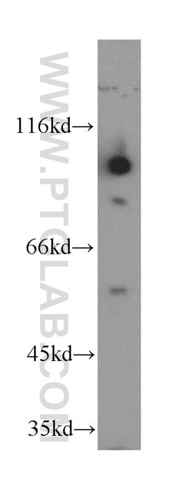 Proteintech GRP94 Rabbit anti-Human, Mouse, Rat, Polyclonal, Proteintech