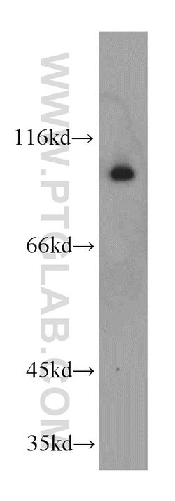 GRP94 Rabbit anti-Human, Mouse, Rat, Polyclonal, Proteintech:Anticuerpos:Anticuerpos