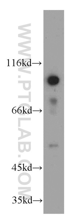 GRP94 Rabbit anti-Human, Mouse, Rat, Polyclonal, Proteintech:Anticuerpos:Anticuerpos