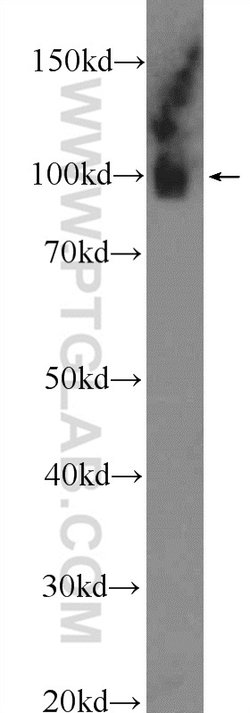 GRP94 Rabbit anti-Human, Mouse, Rat, Polyclonal, Proteintech:Anticuerpos:Anticuerpos